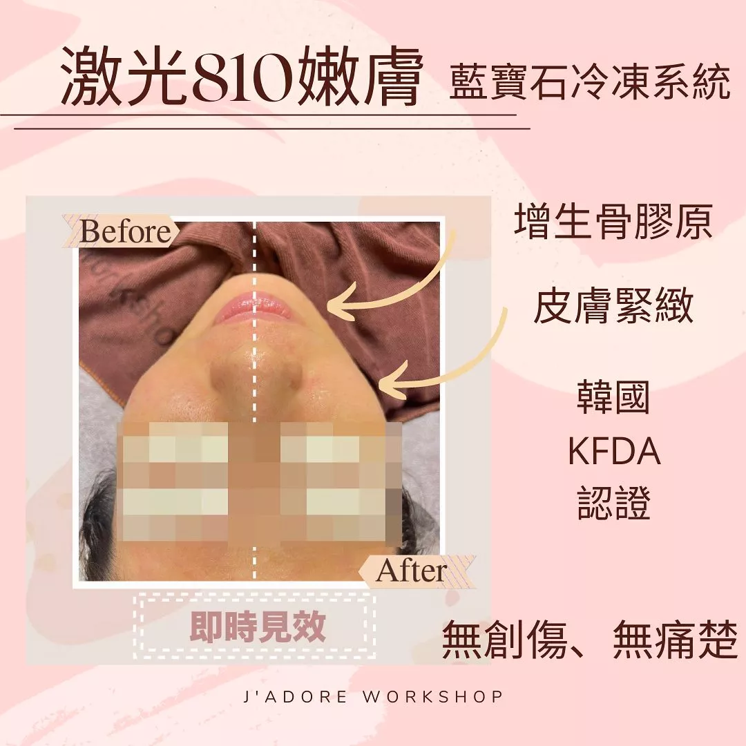 product cover