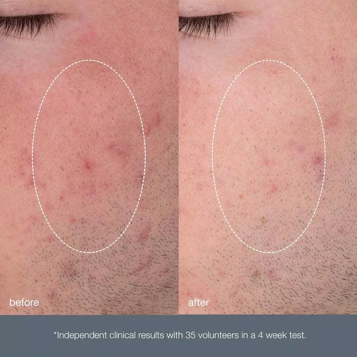 product cover