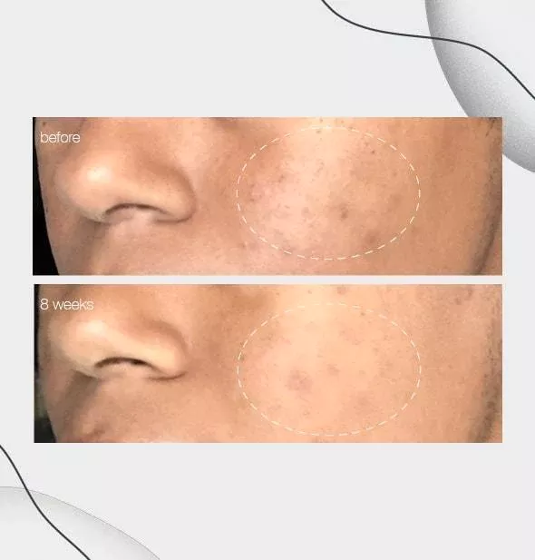 product cover