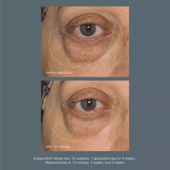 product cover