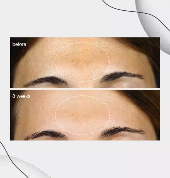product cover