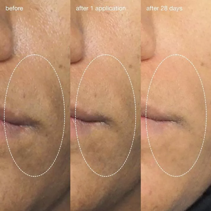 product cover