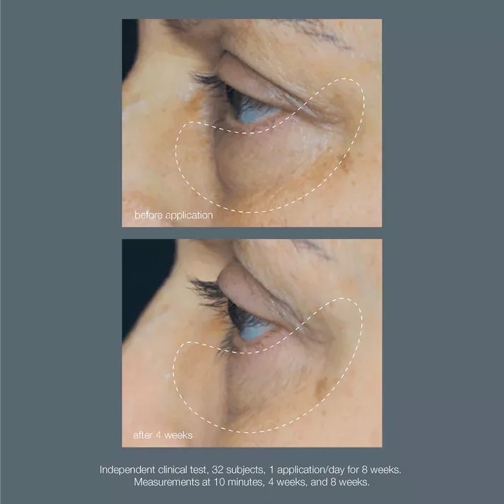 product cover